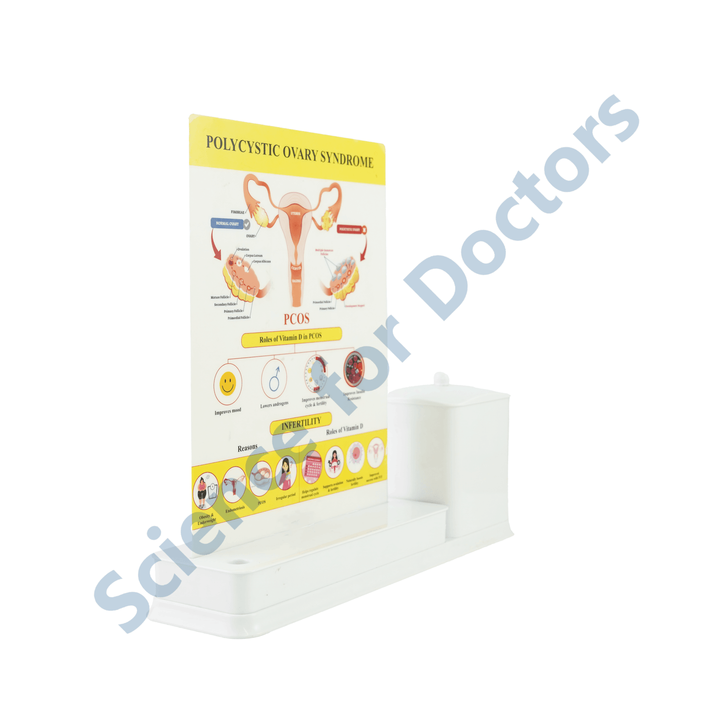 PCOS: 1 Slides Write & Wipe with Stationary Stand