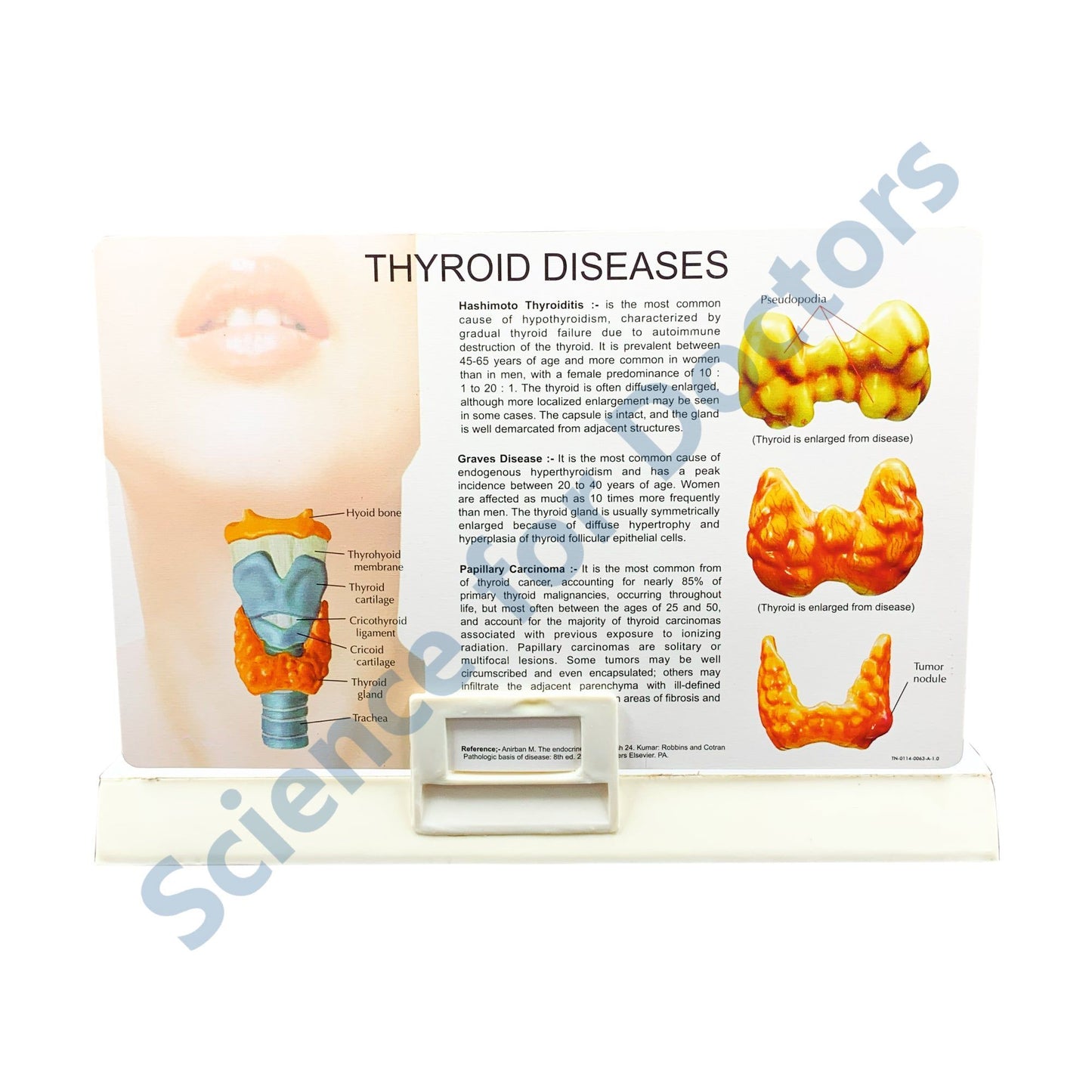 Hypothyroidism: 3D Anatomical Models