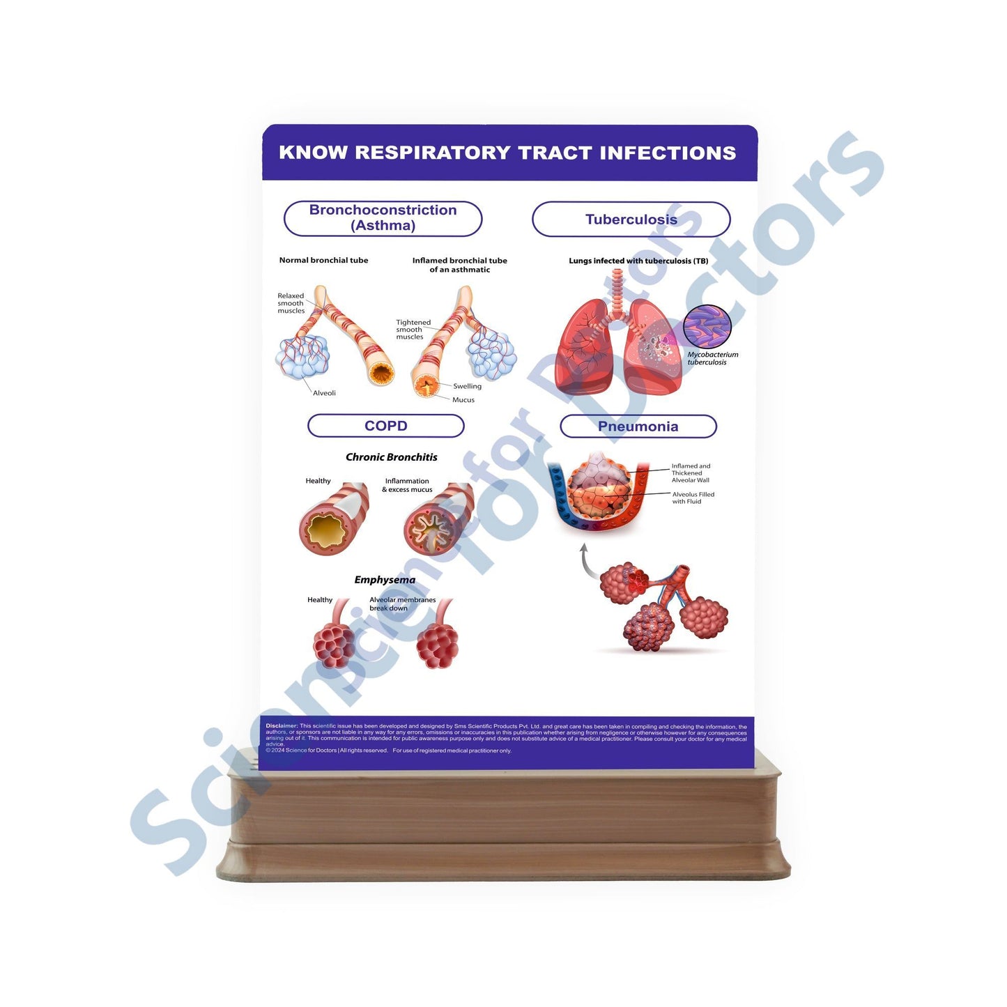 Know Urinary Tract System: 2 Slides on stand