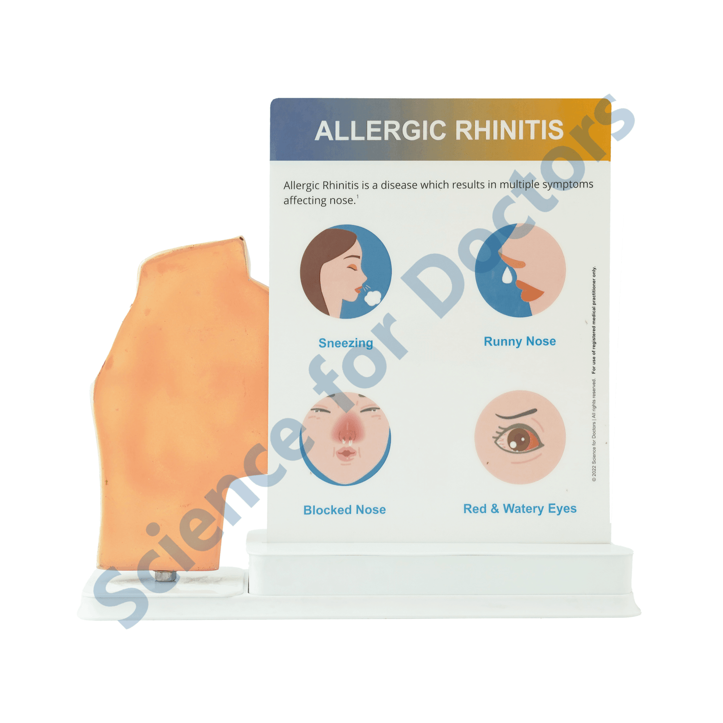 Allergic Rhinitis : 1 Slide write and wipe with anatomical model on stand