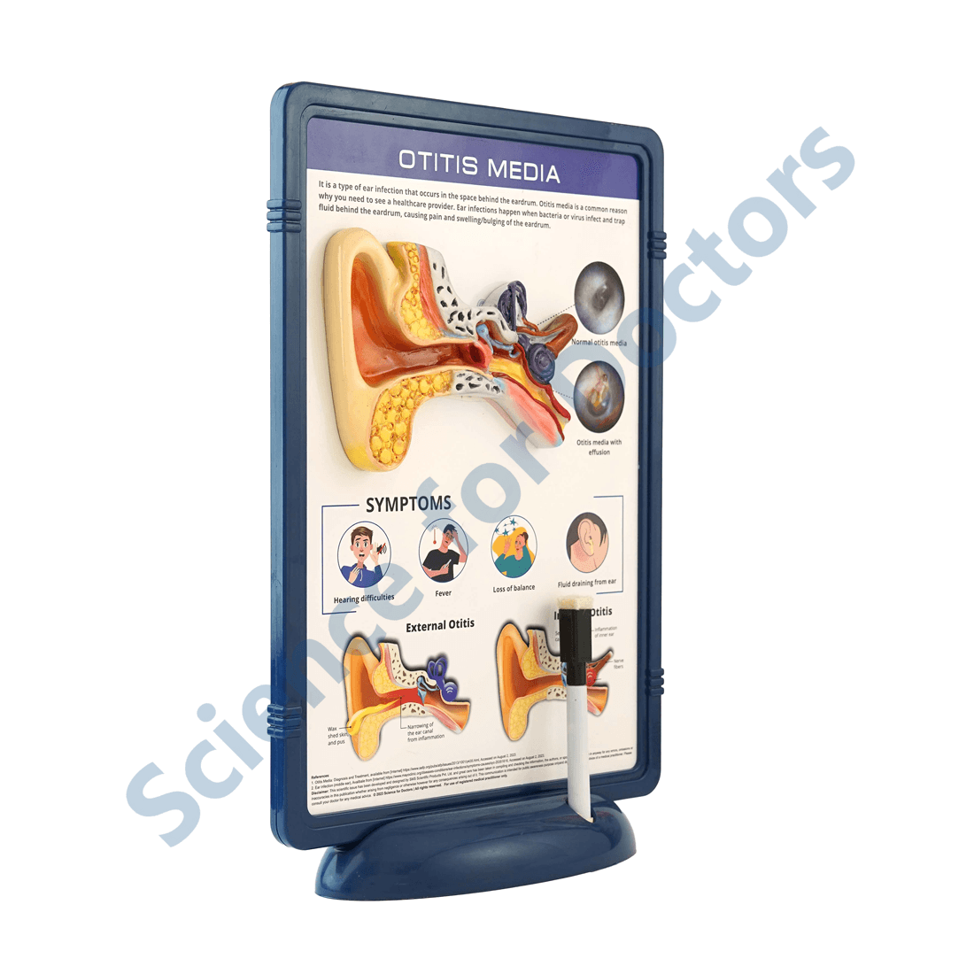 Otitis Media: 3D Therapy Frame