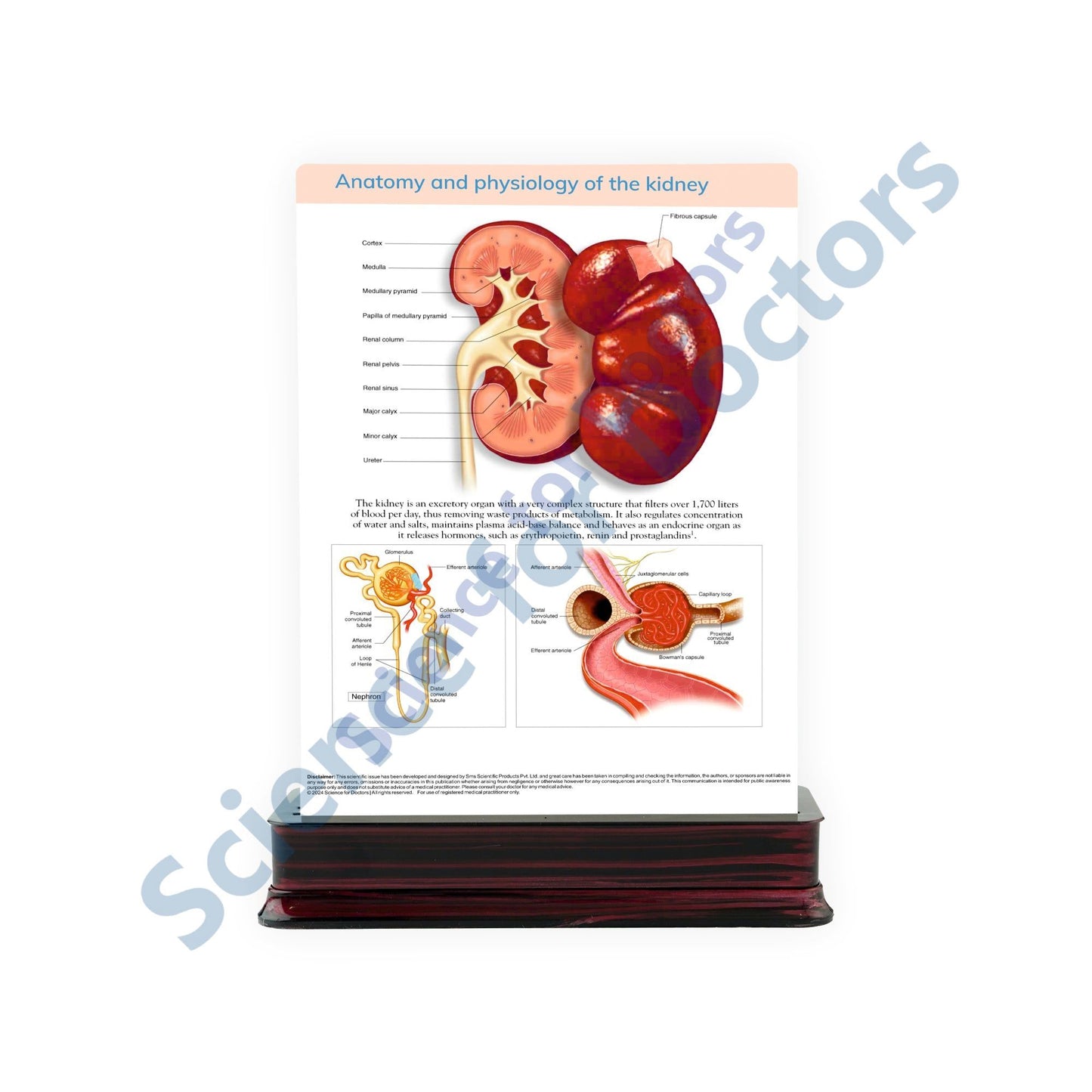 Diabetic Nephropathy: 3 Slides on Stand