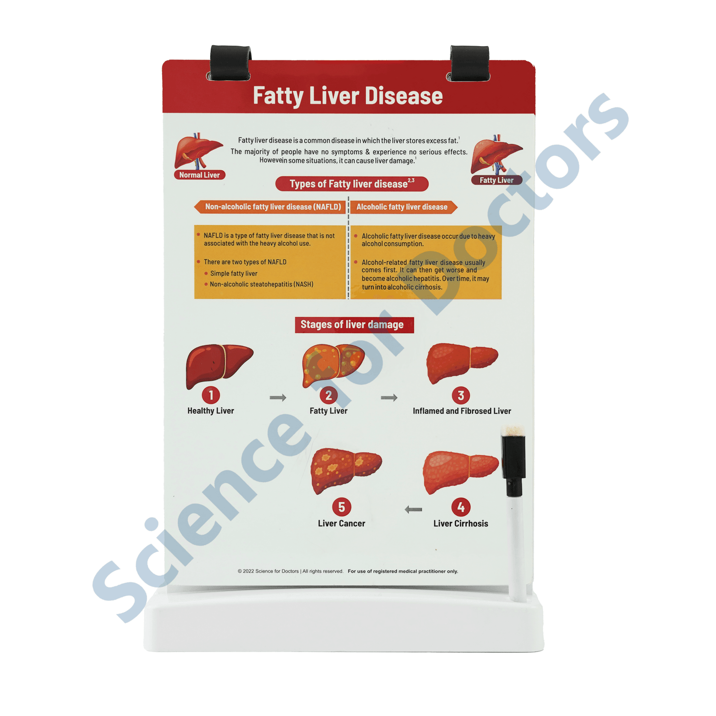 Fatty Liver Disease: A4 Flip Wipe with 3D Therapy Board