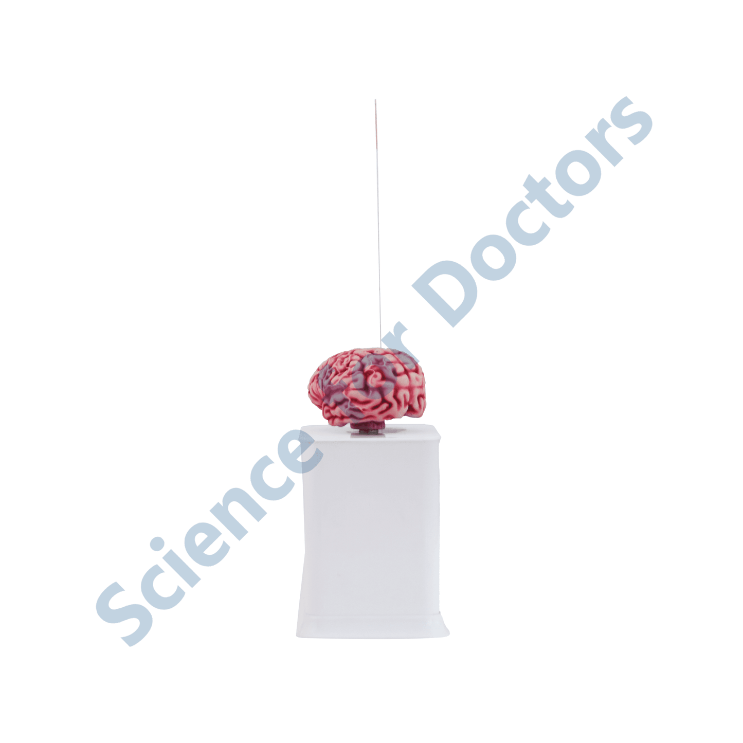 Macrovascular Complications Diabetic Cerebrovascular Diseases : 1 Slide write and wipe with anatomical model on stand