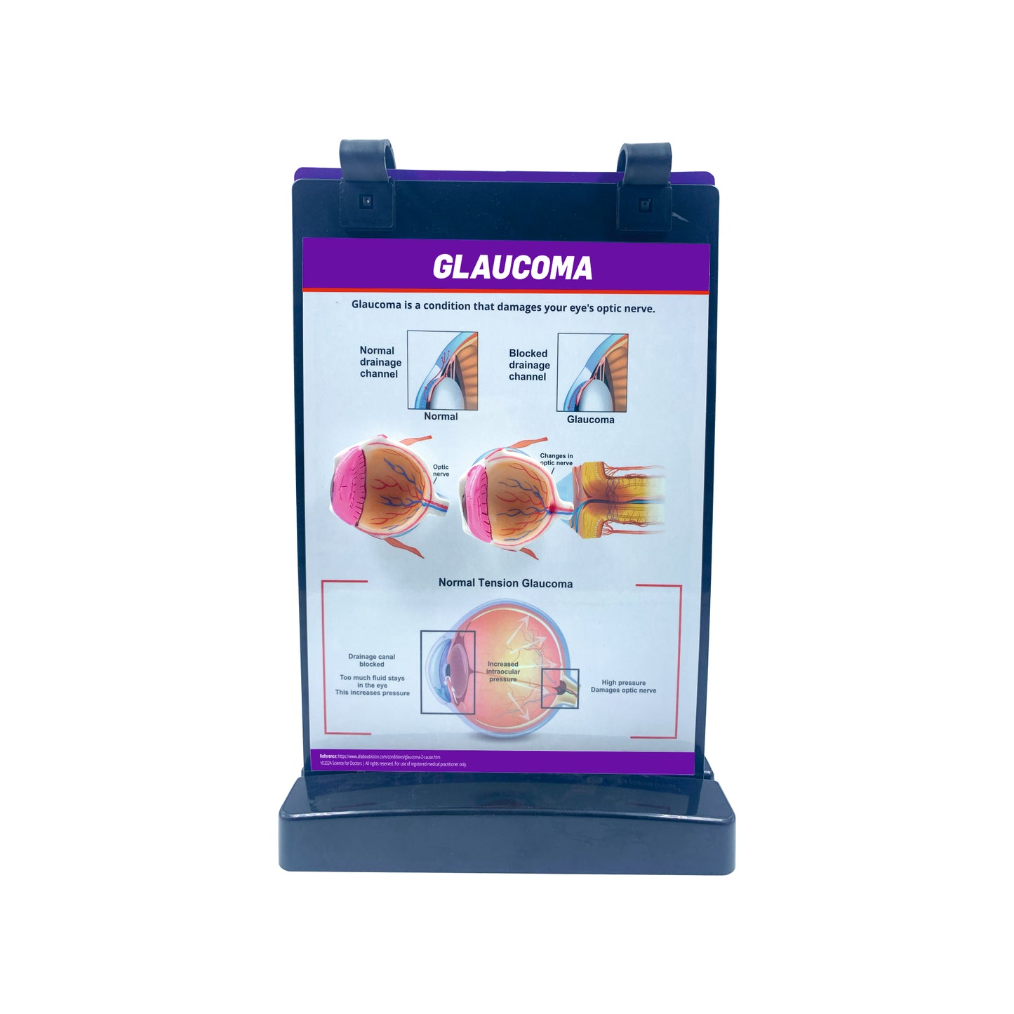 A4 Flip Wipe with 3D Therapy Board - Eye Anatomy