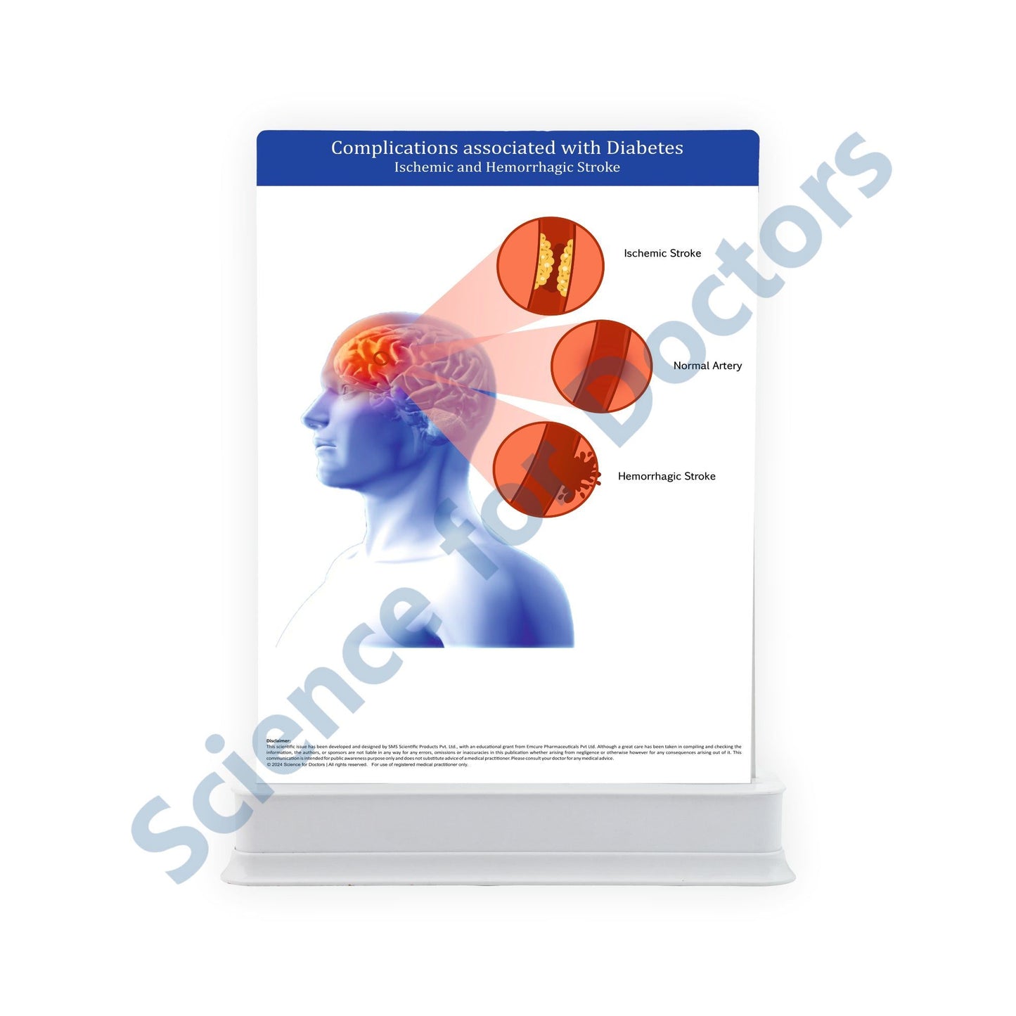 Complications associated with Diabetes: 2 Slides Patient Leaflet Tray