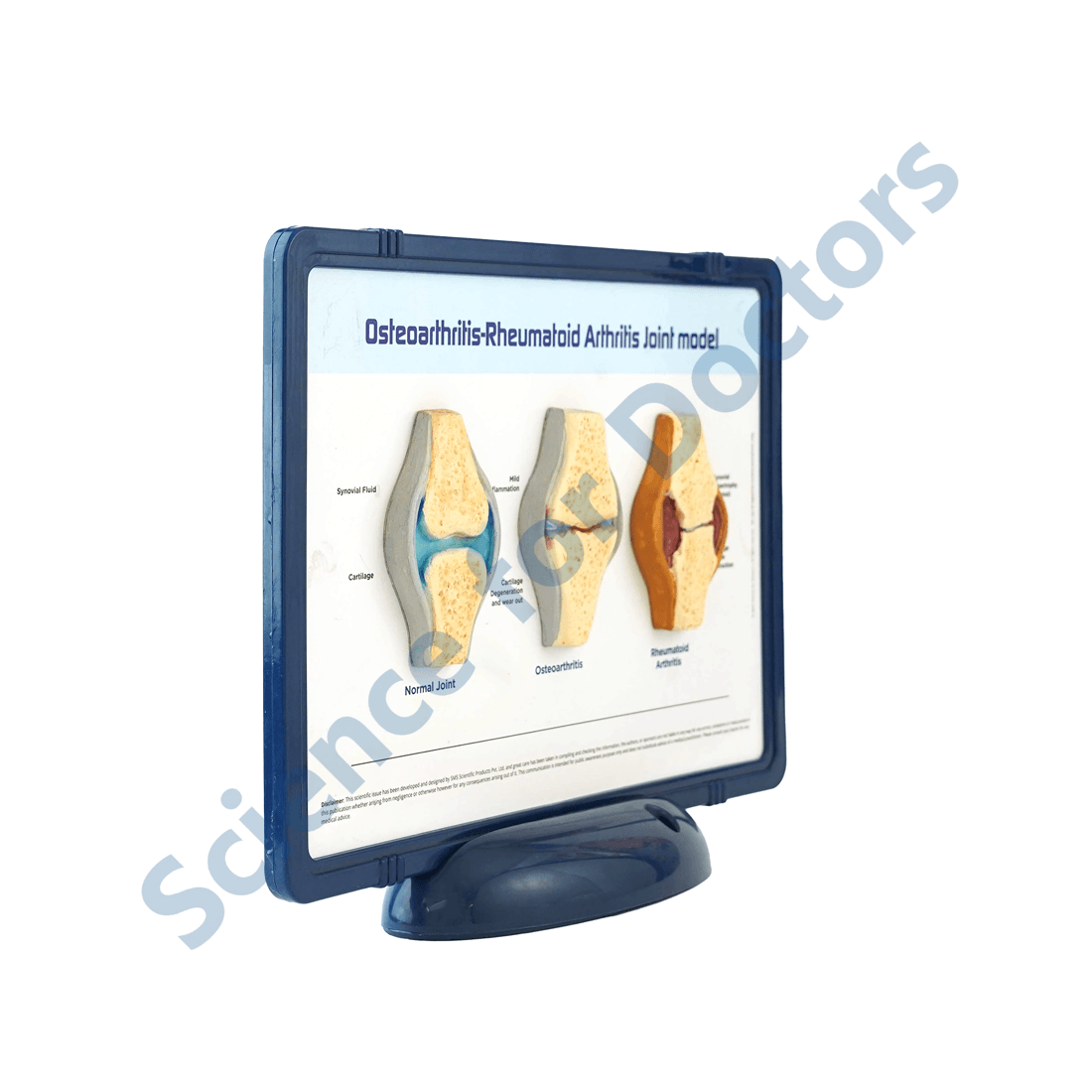 Osteoarthritis-Rheumatoid Arthritis Joint: 3D Therapy Frame