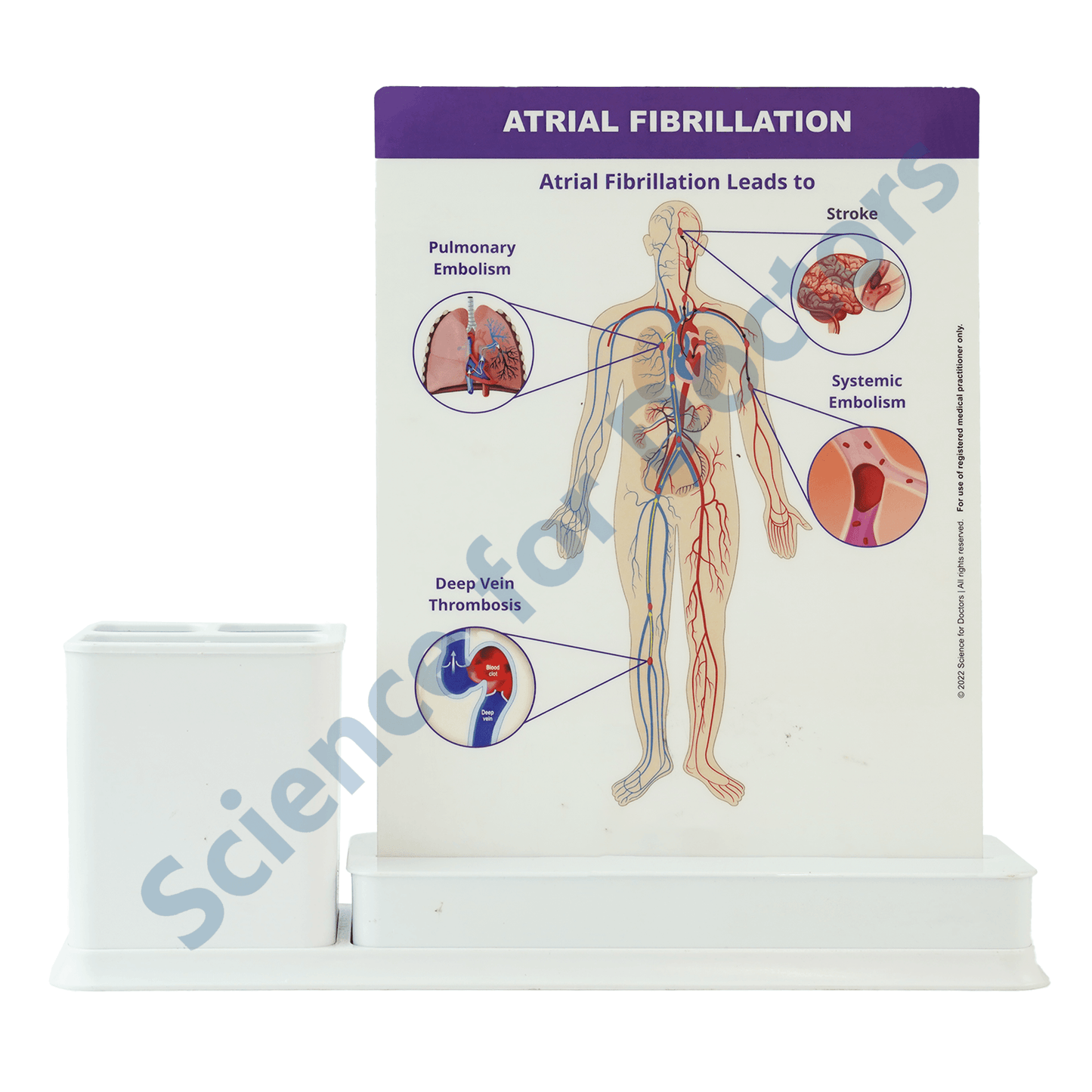 Atrial Fibrillation : 1 Slide Write and wipe with anatomical model on stationery stand