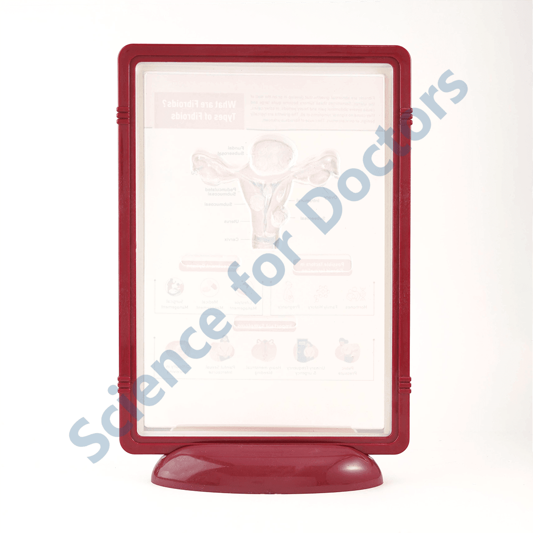 Fibroids: 3D Pop Up Frame* (MOQ 300)