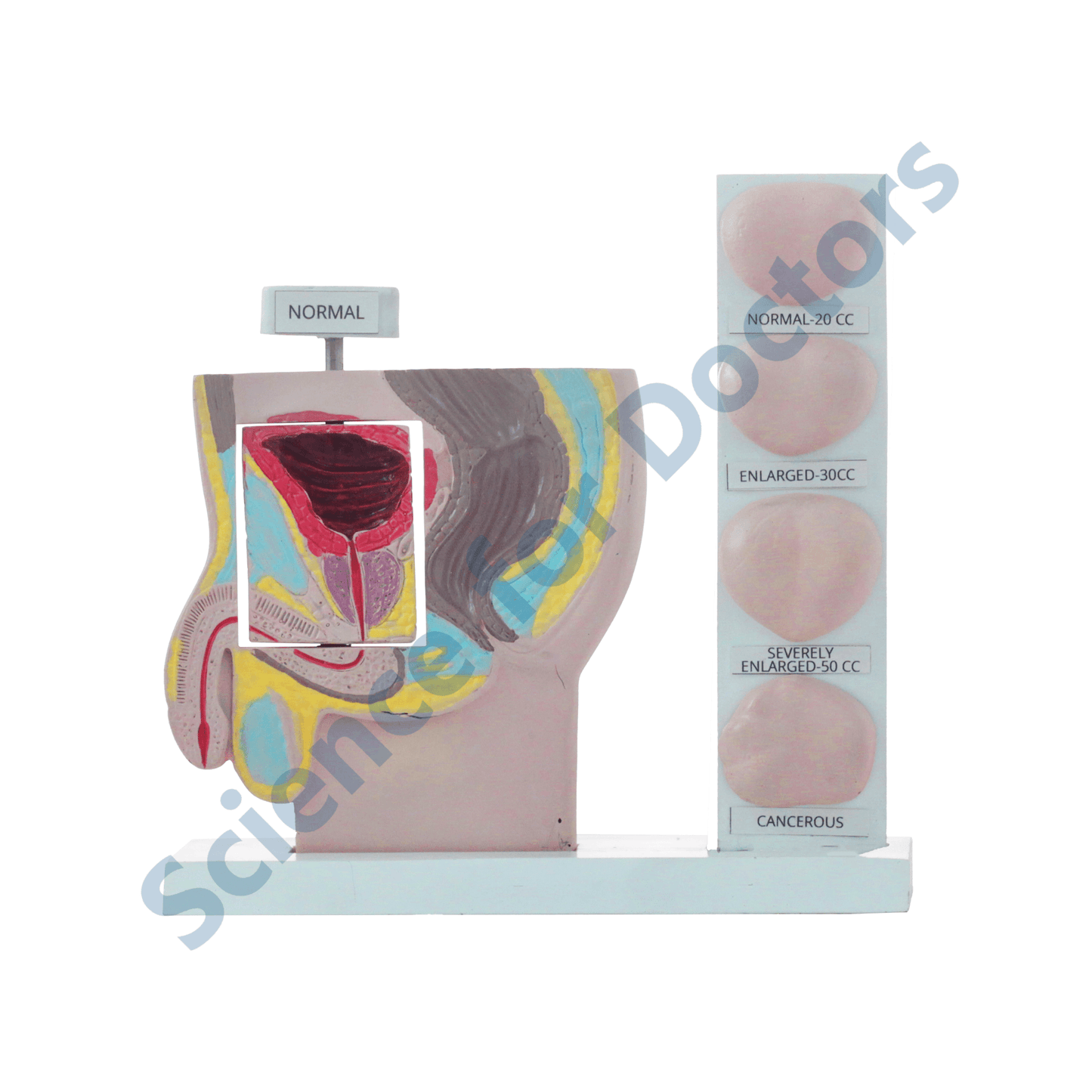 Prostate: 3D Anatomical Models