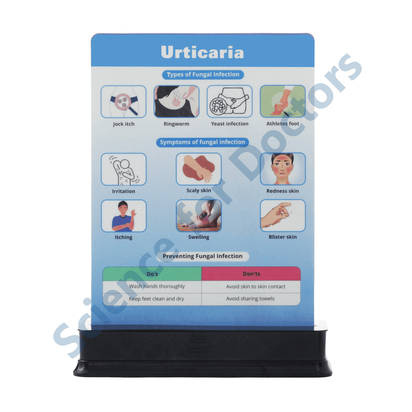 Urticaria: 1 Slide on stand