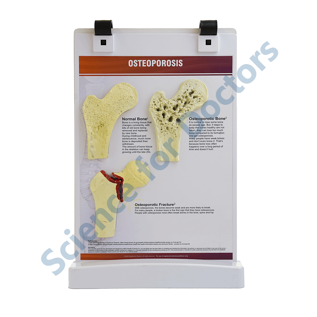 Osteoporosis: A4 Flip Wipe with 3D Therapy Board