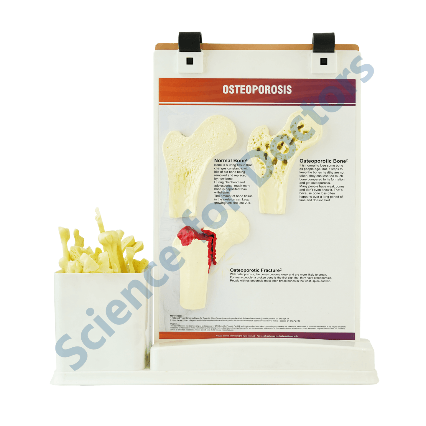 Osteoporosis: A4 Flip Wipe With Anatomical Model