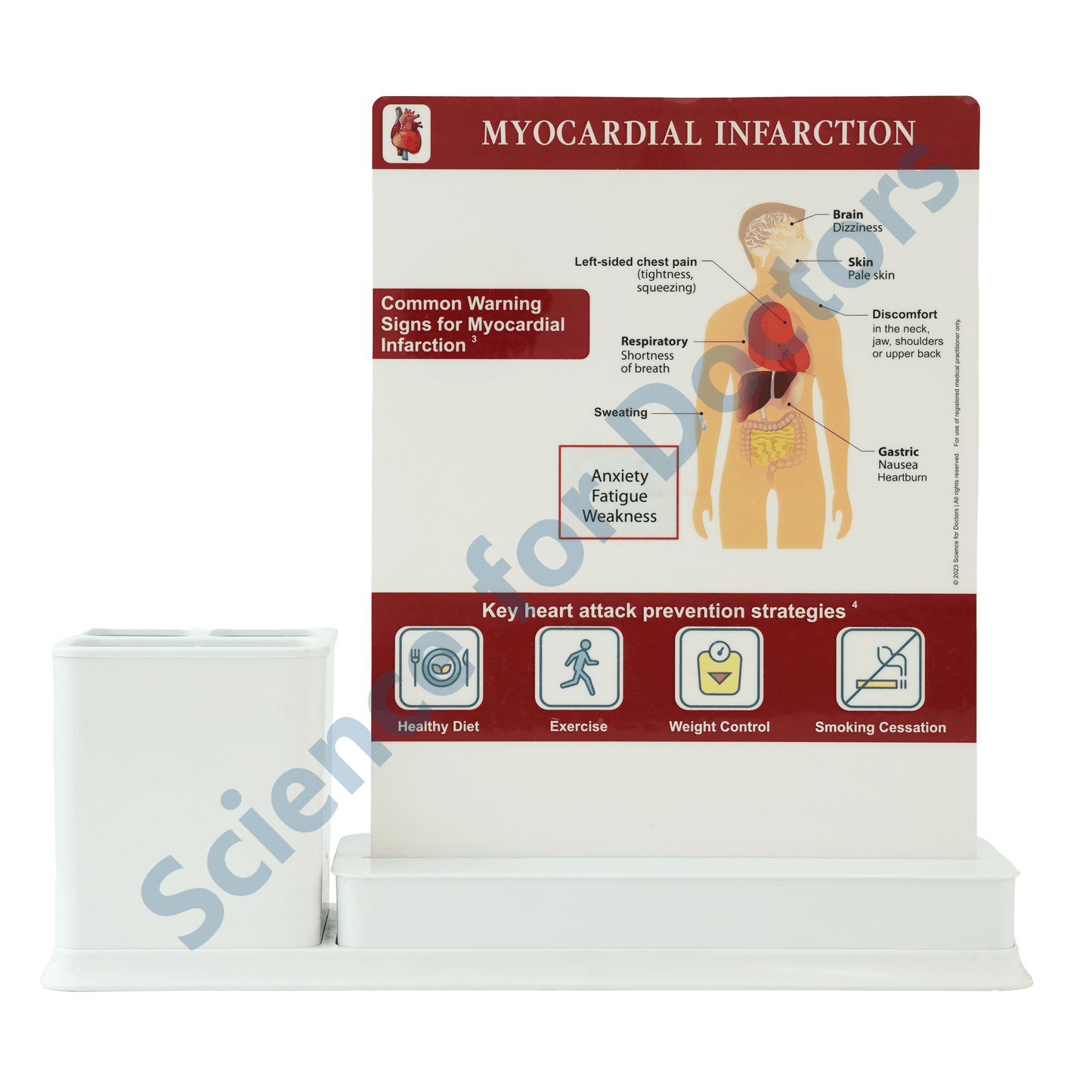 Myocardial Infraction : 1 Slide Write and wipe with anatomical model on stationery stand