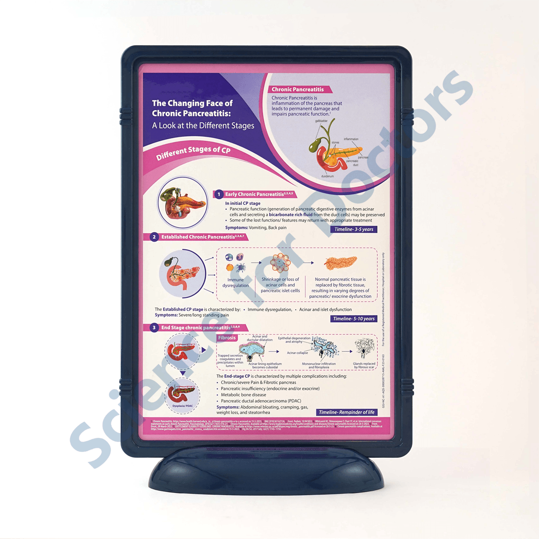 Stages of Chronic Pancreatitis: 3D Therapy Frame