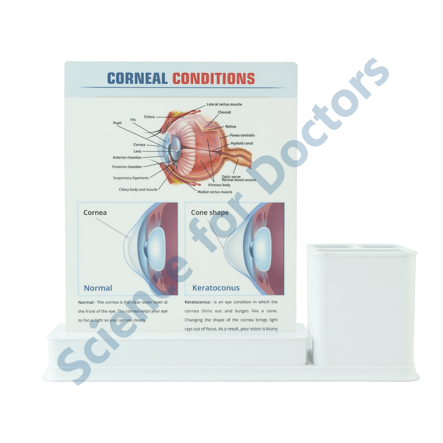 Corneal Conditions: 1 Slides Write & Wipe with Stationary Stand