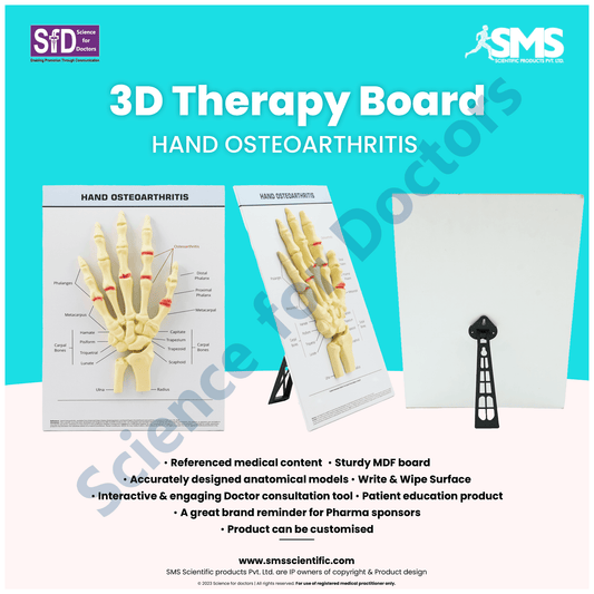 Hand Osteoarthritis: 3D therapy Board