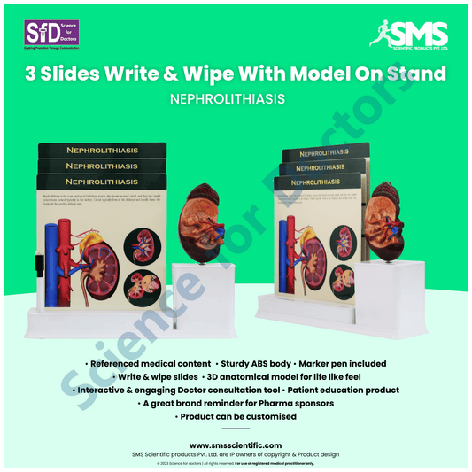 Nephrolithiasis : 3 Slide Write and Wipe with Anatomical Model on Stand