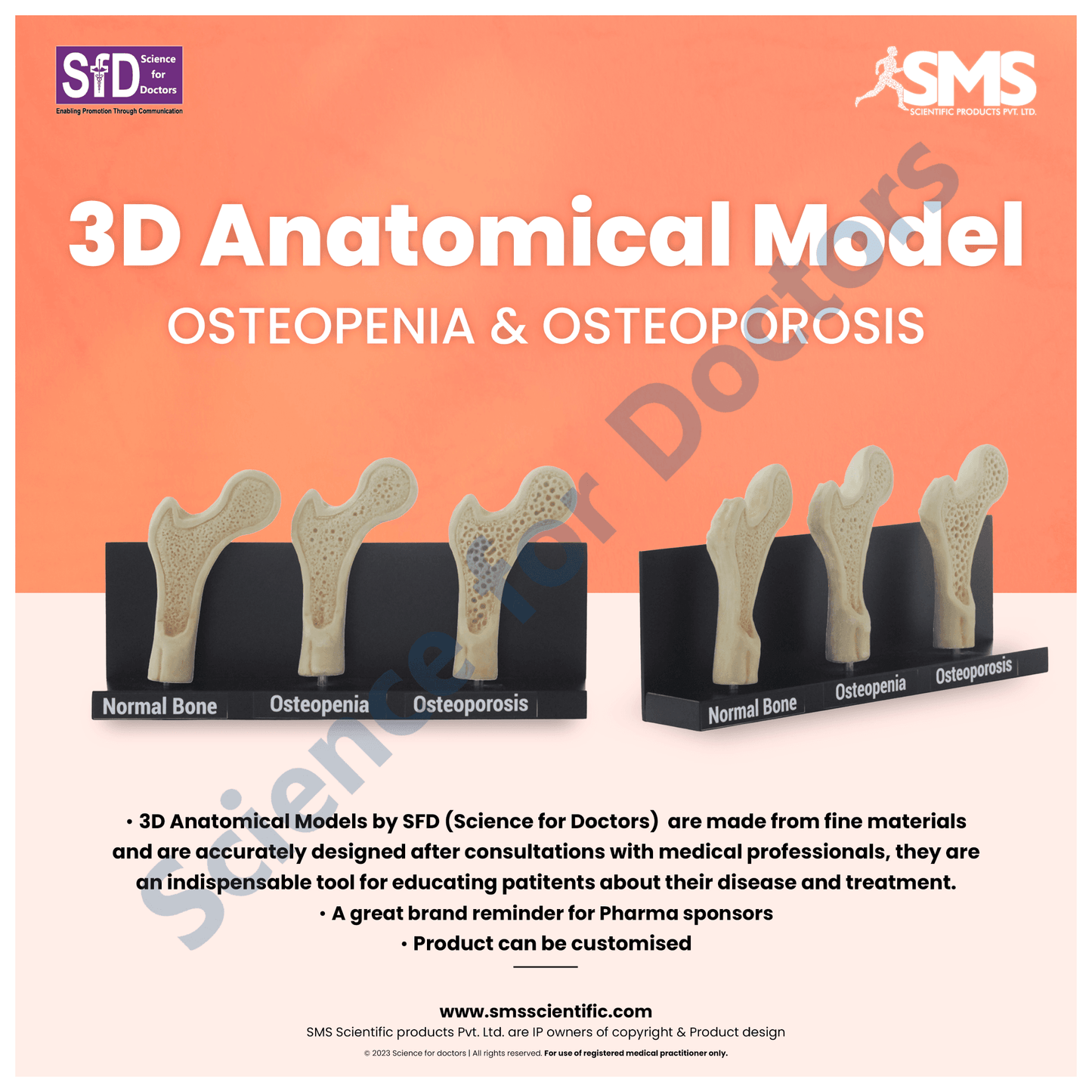 Osteoporosis: 3D Anatomical Models