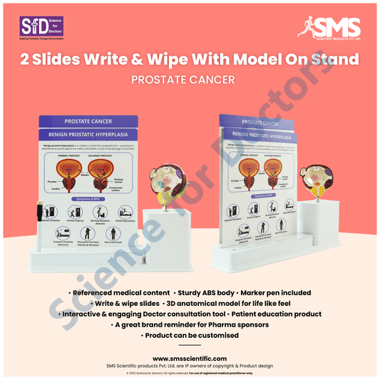 Prostate Cancer : 2 slide Write and Wipe with Anatomical Model