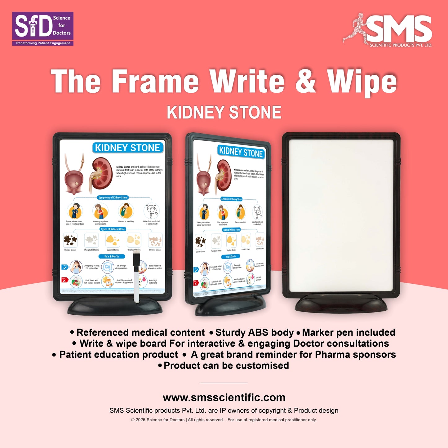 Kidney Stone: The Frame Write & Wipe