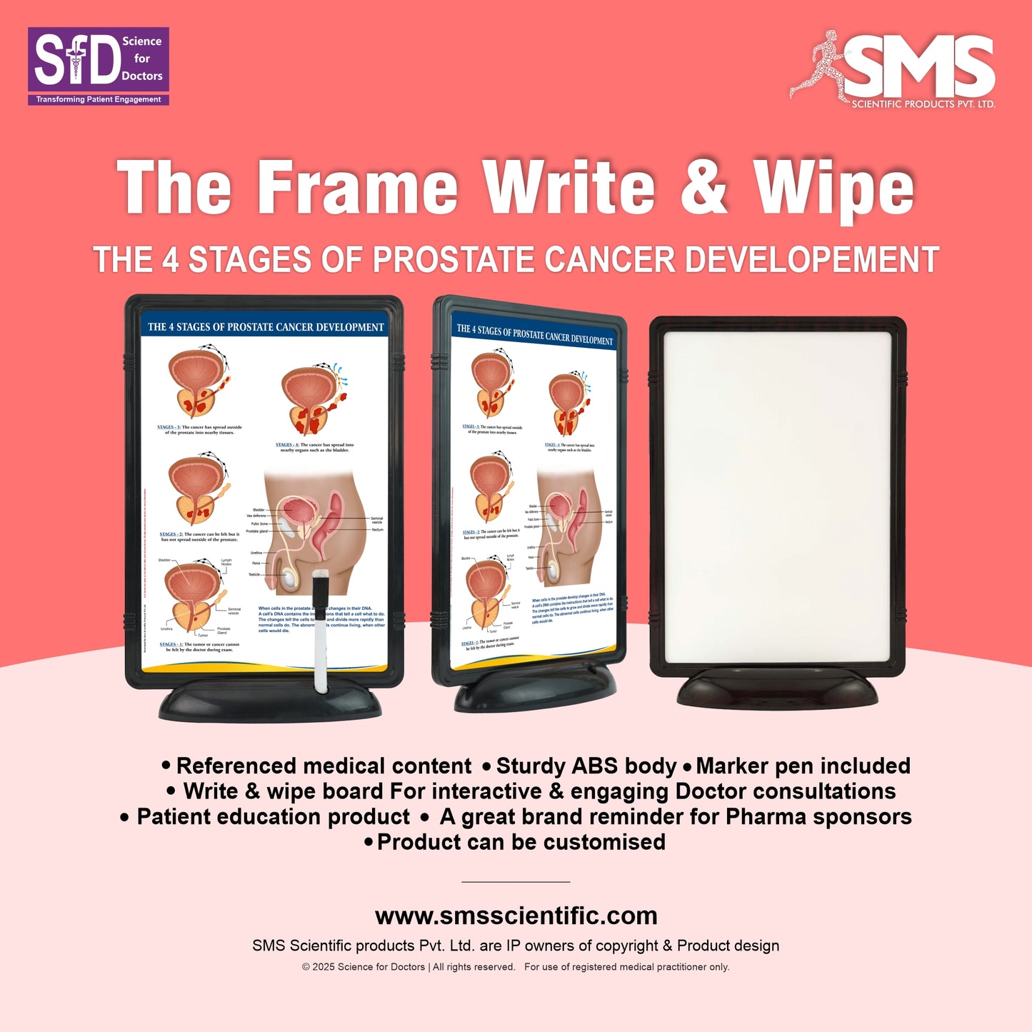 The 4 Stages of Prostate Cancer Development: The Frame Write & Wipe