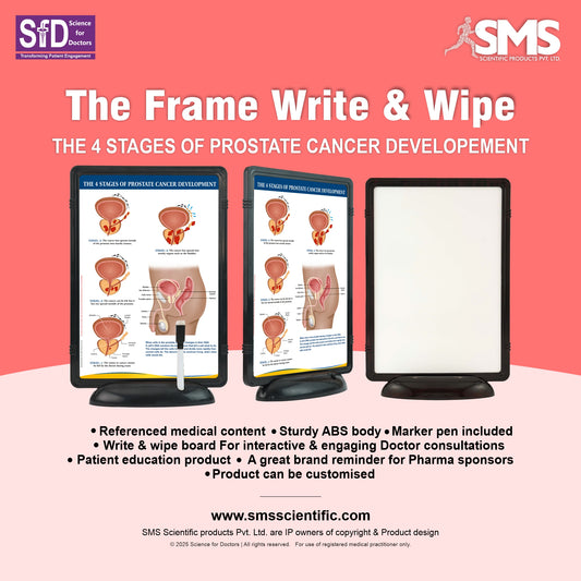 The 4 Stages of Prostate Cancer Development: The Frame Write & Wipe